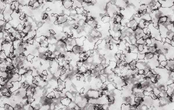 Present Traits and Advances in Gold Bars For Sale